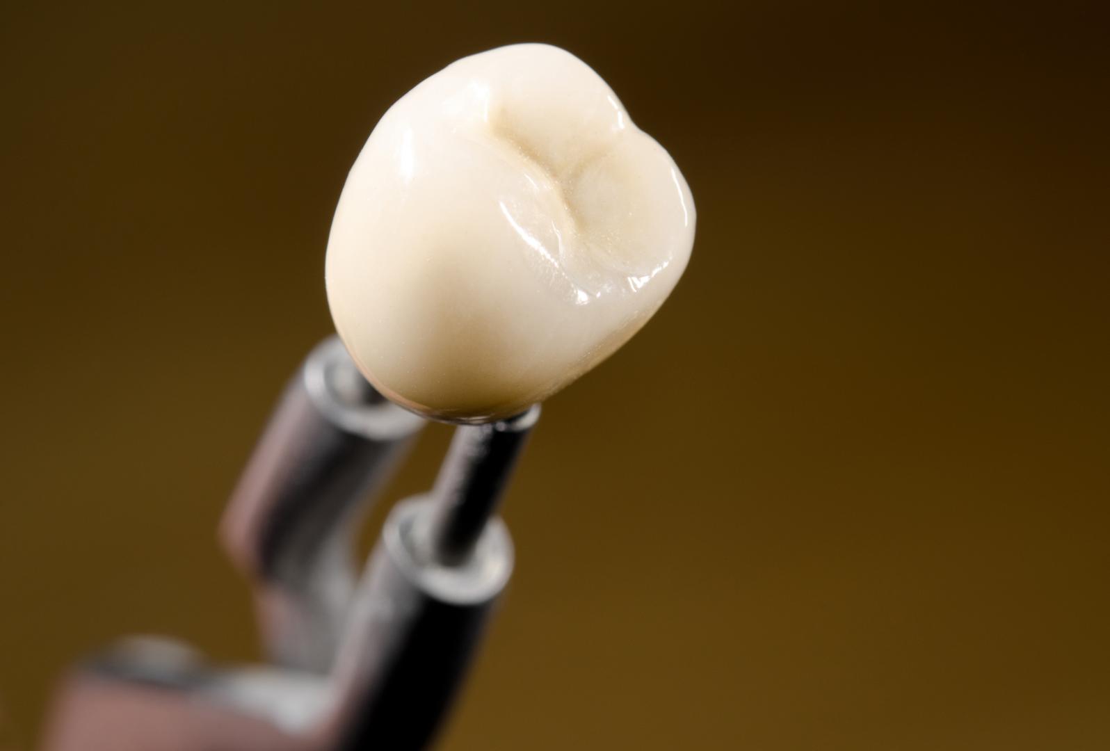 Dental Crowns & Bridges Dandenong