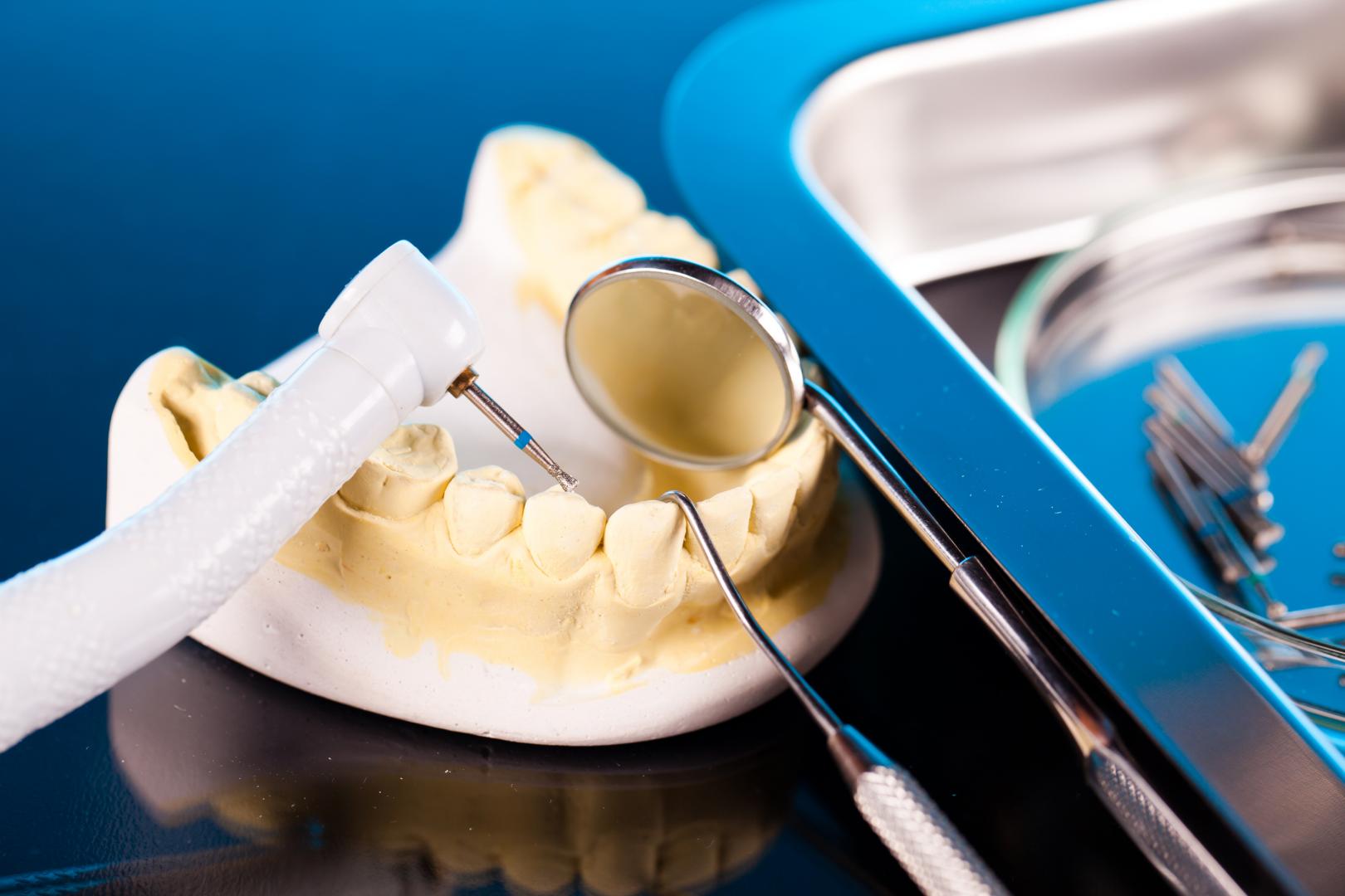 Dental Crowns & Bridges Dandenong